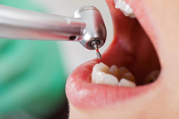 Best Tooth Infection Emergency Dentist  in Negaunee, MI